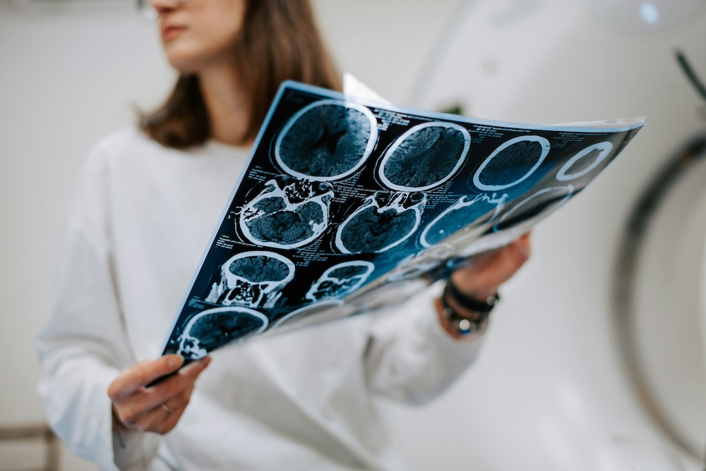 Neurology - Neurology Consultation and Diagnostic Units