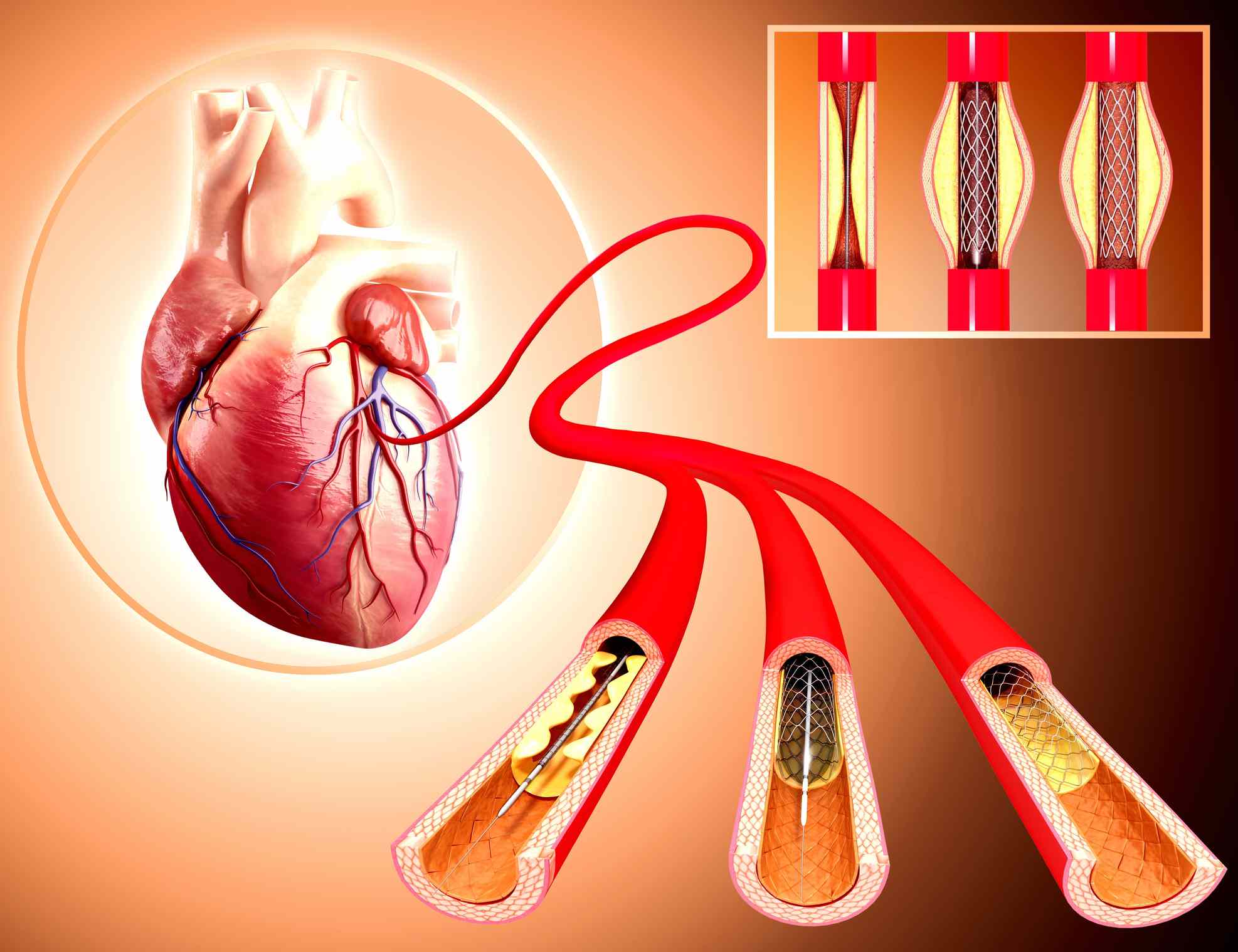 Interventional Radiology - Angiography and Imaging Labs