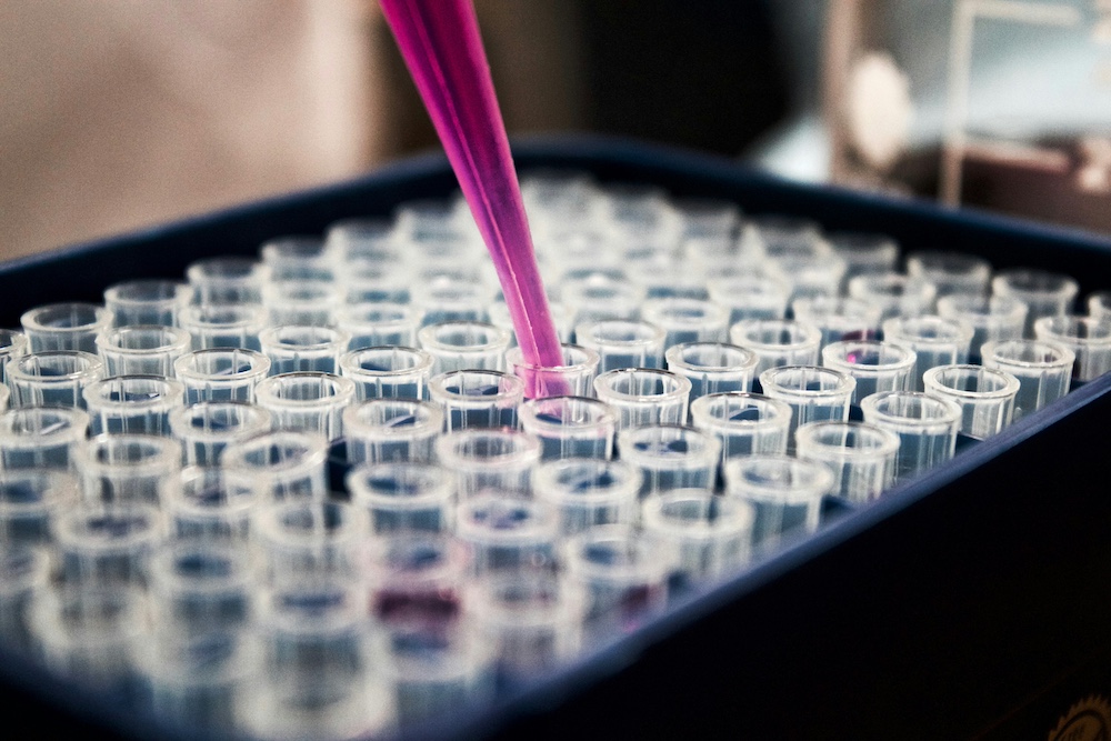 Gastroenterology - Liver Function Testing Lab