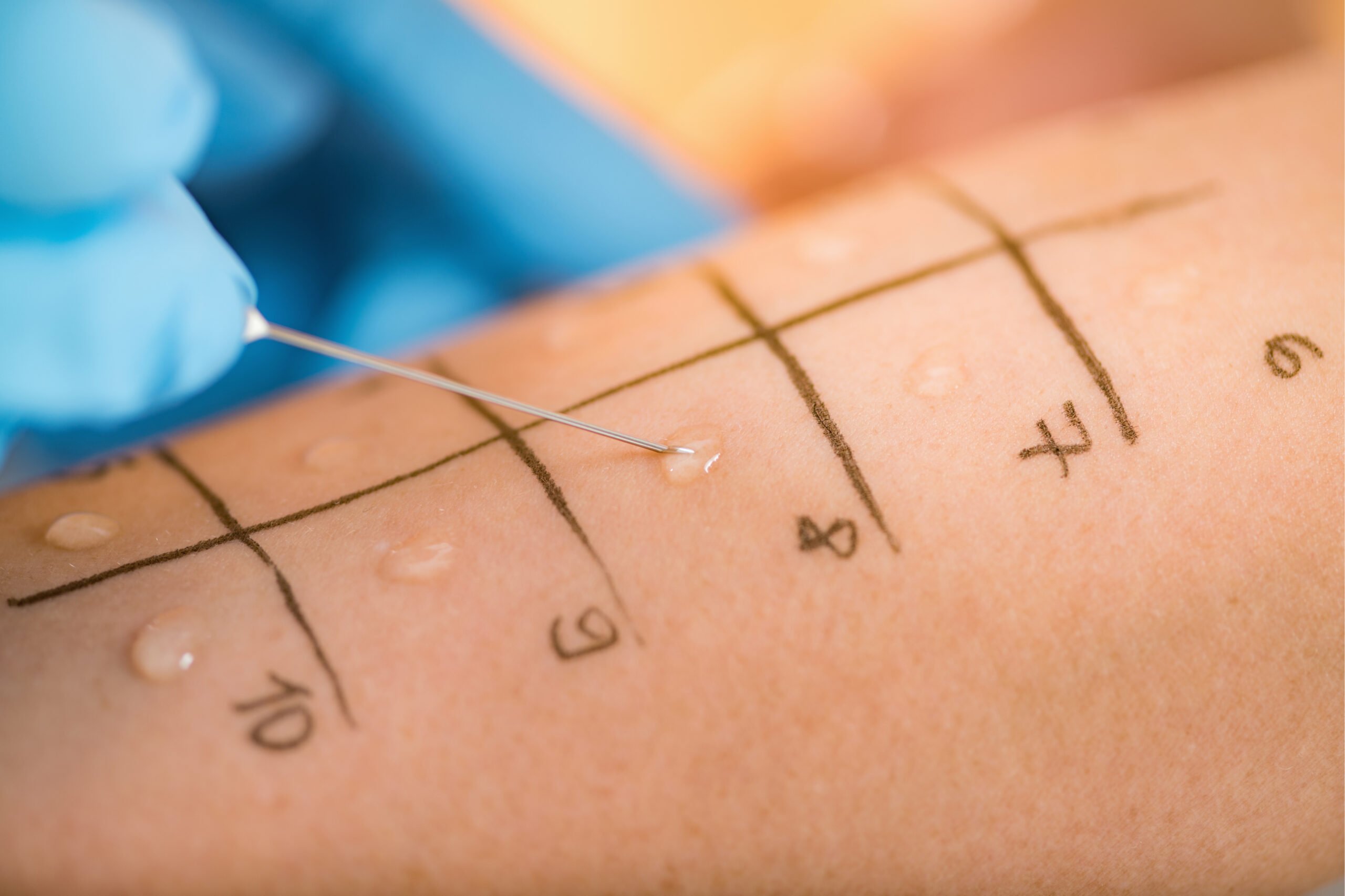 Dermatology - Patch Test and Allergy Testing Units