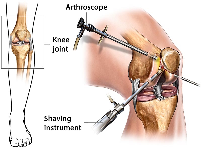 Orthopedics - Arthroscopy and Joint Care Unit