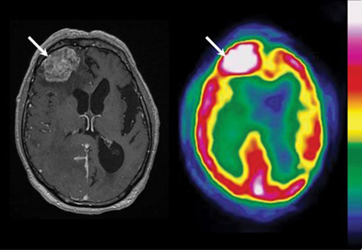 Neurosurgery & Spine - Neuroimaging and Diagnostic Services