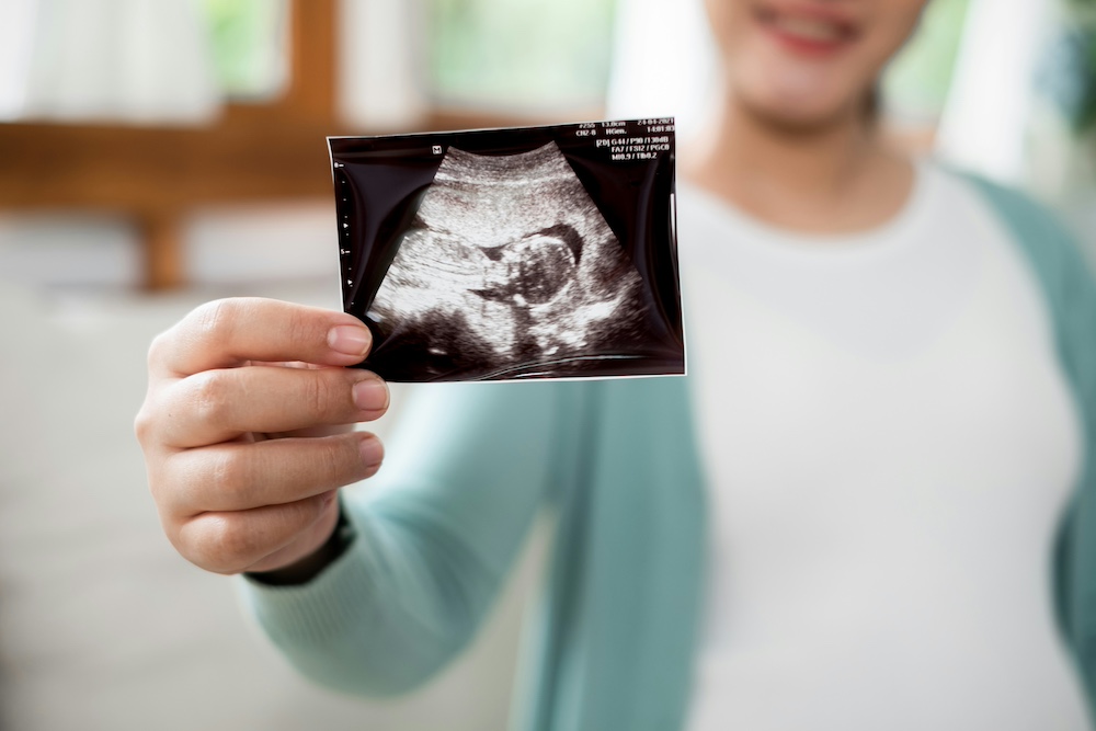Radiology - USG (Ultrasound)