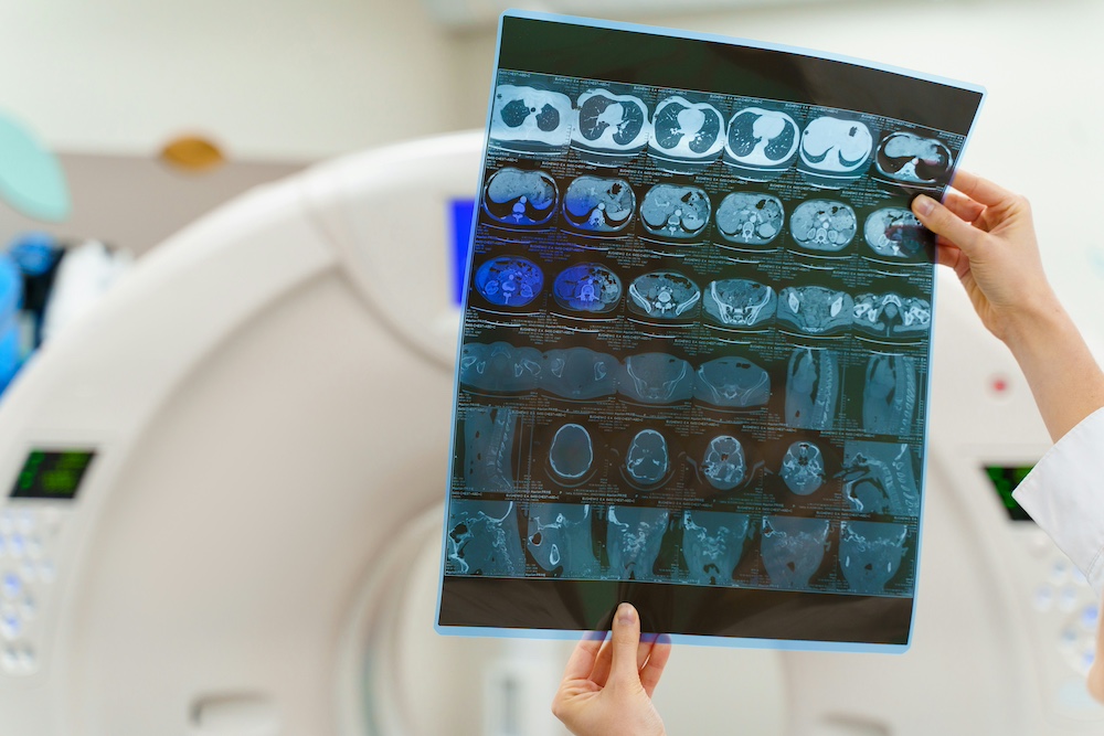 Radiology - CT-Scan