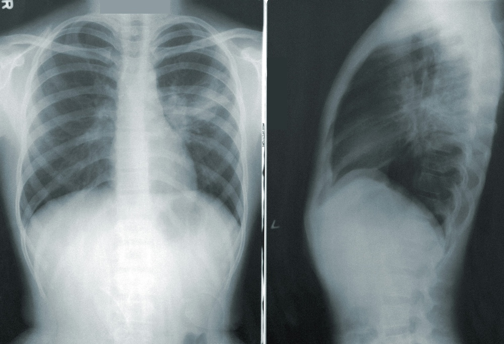 Radiology - X-Ray