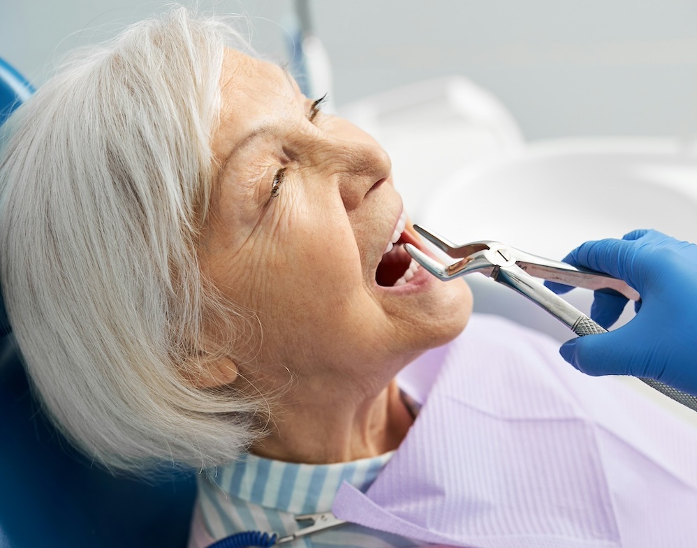 Tooth Extraction