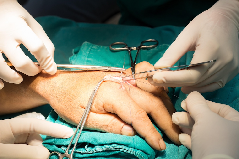 Hand Surgery