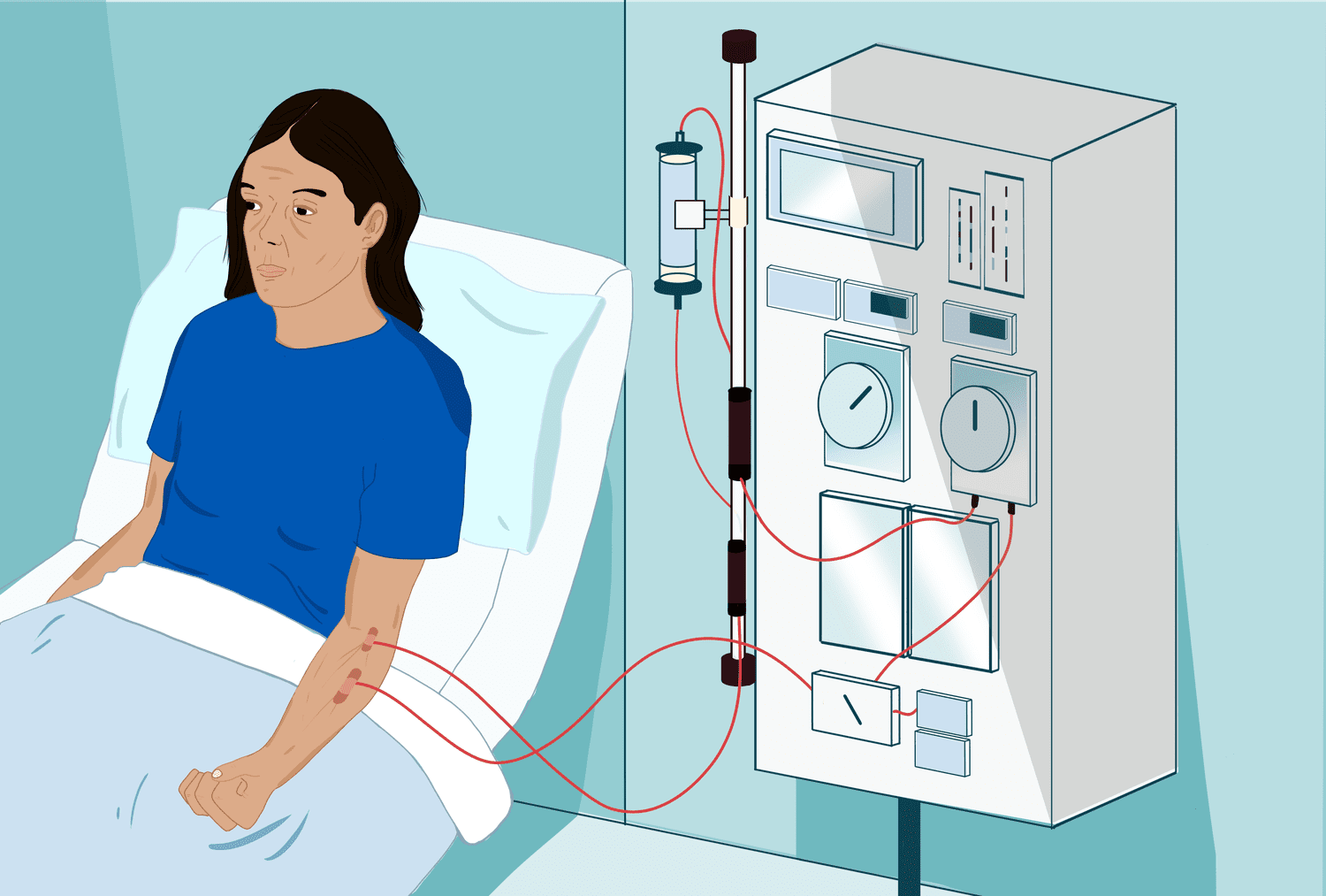 Dialysis