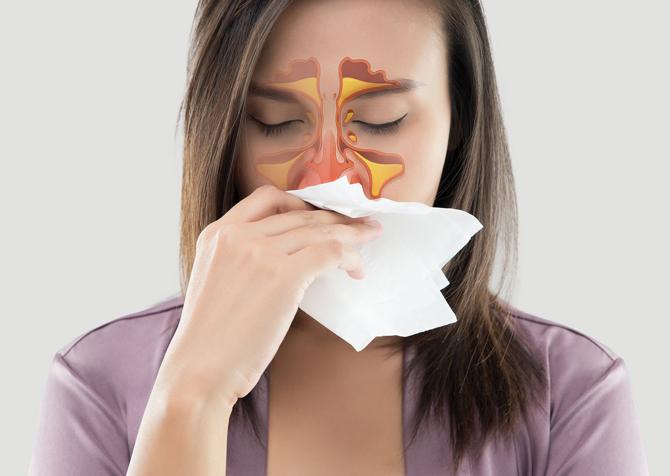 Sinusitis Treatment