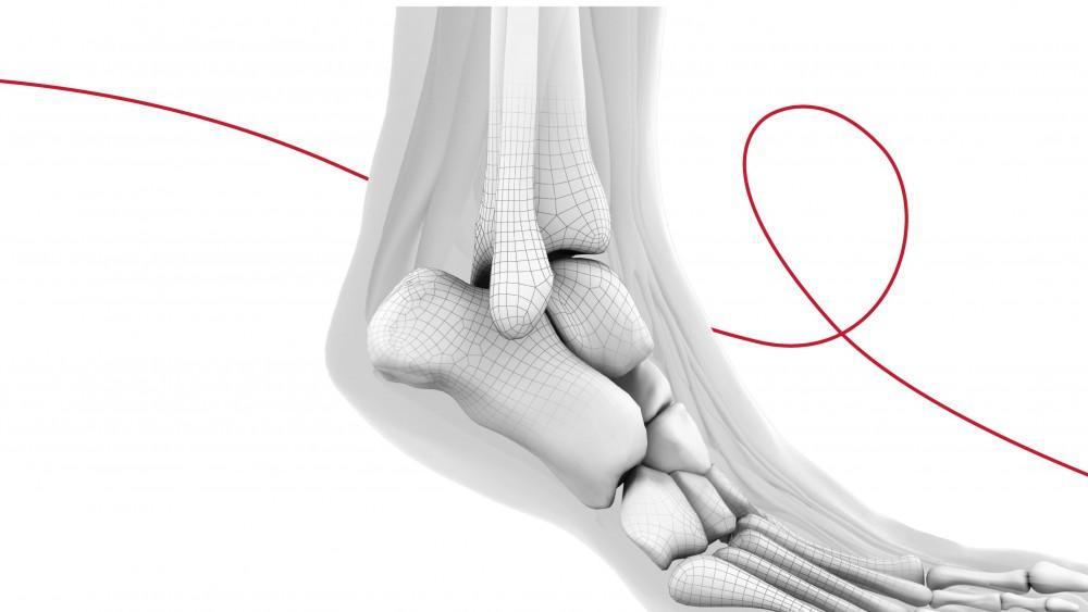 Tendon and Bone Surgery