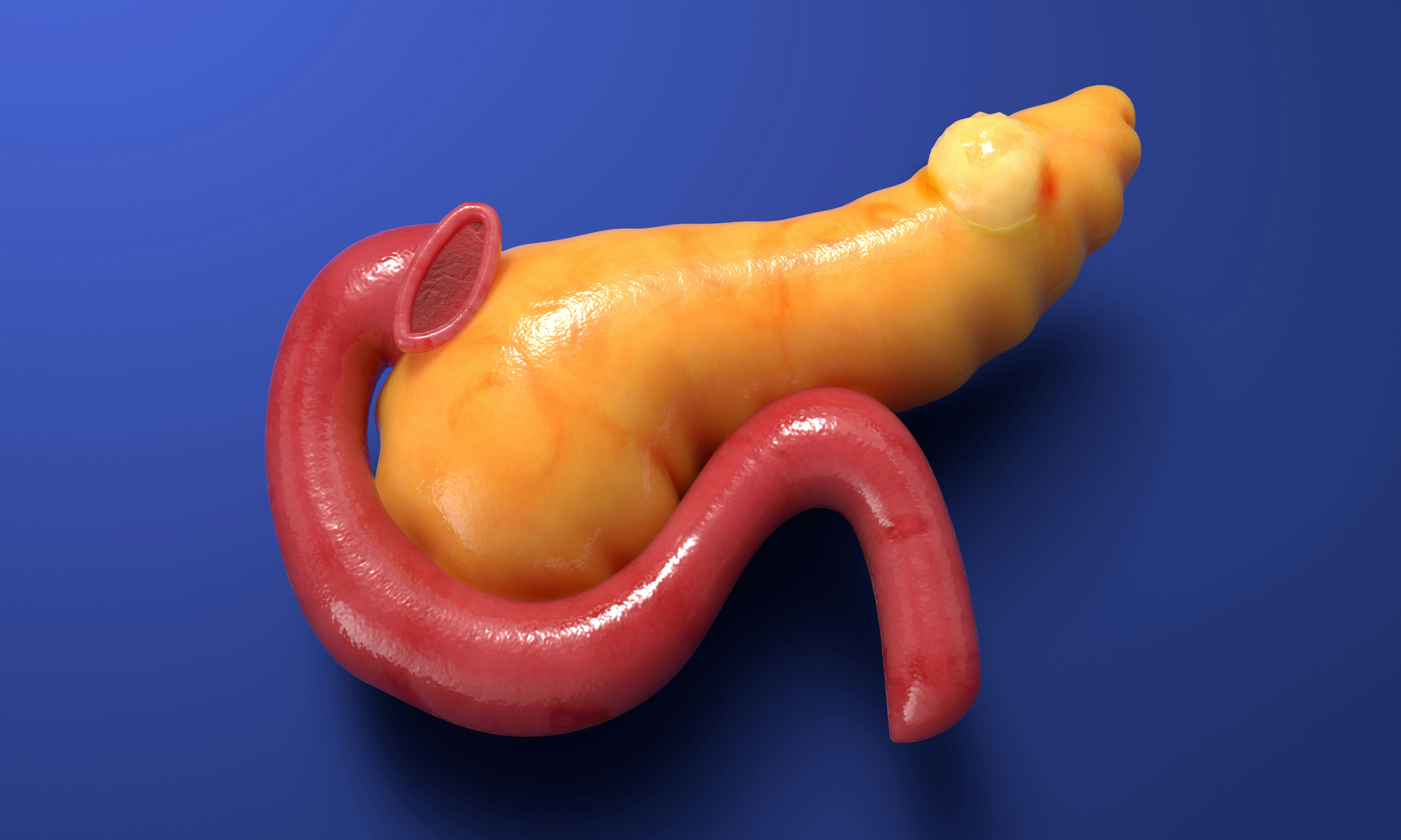 Gallbladder Disease Treatment