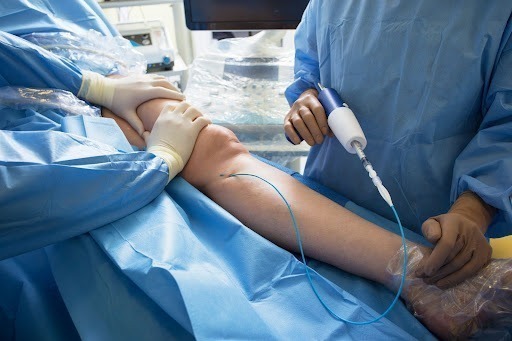 Varicose Vein Surgery