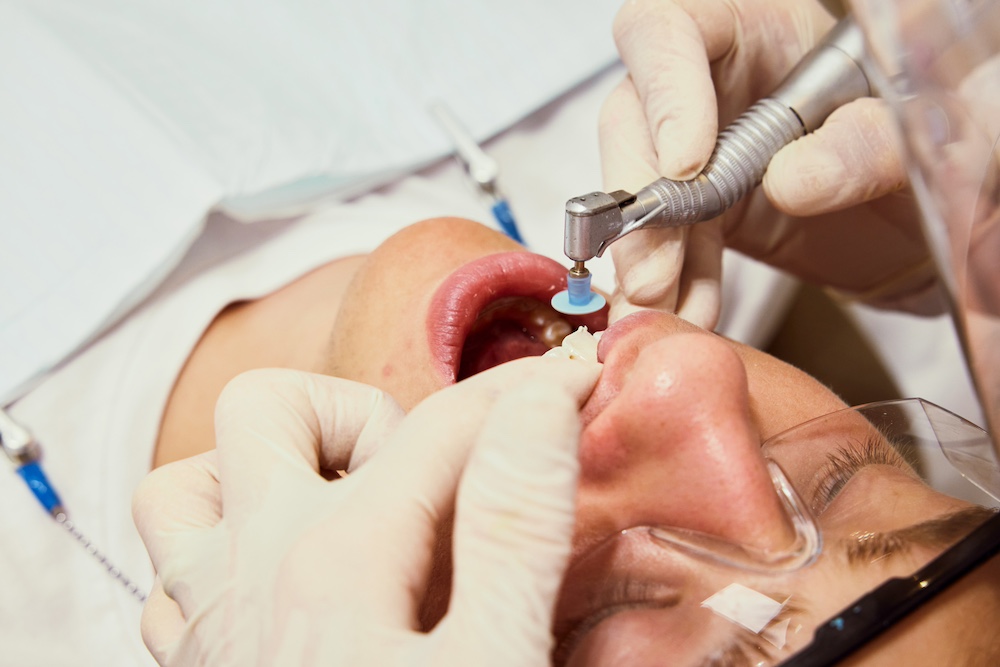 Root Canal Treatment
