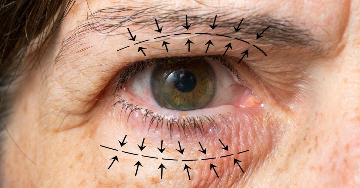 Oculoplastic and Reconstructive Surgery
