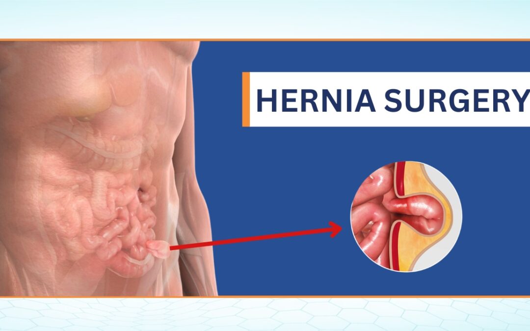 Hernia