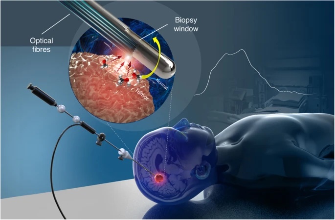 Image-Guided Biopsy
