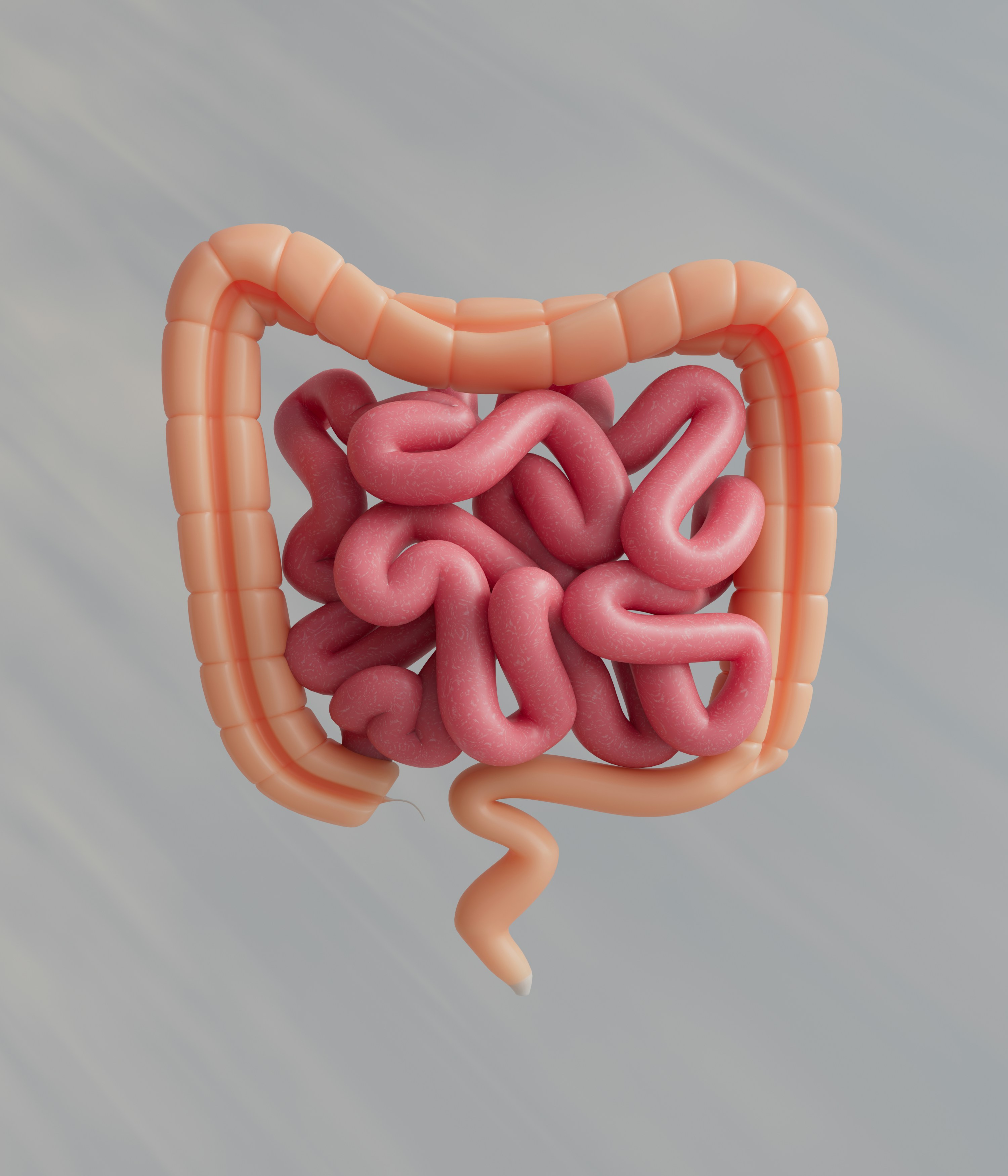 Gastric Bypass Surgery (Roux-en-Y)