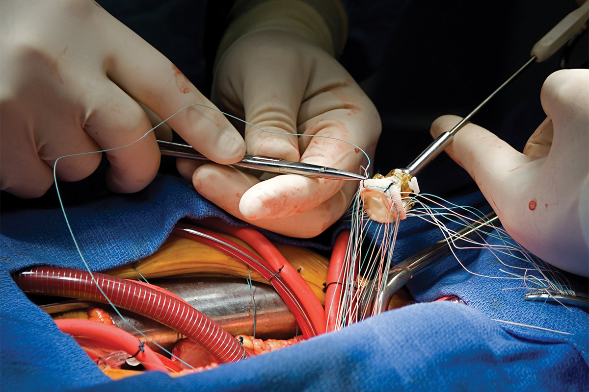 Cardiac Surgery & Structural Heart Treatments
